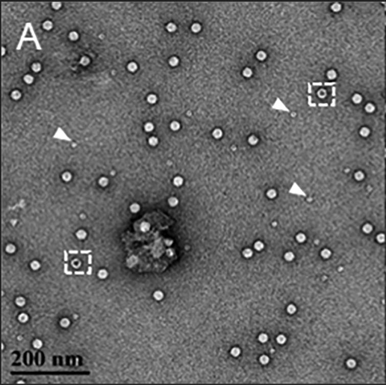 Image showing small particles (white arrow) and empty AAV capsids (dashed white box) under transmission electron microscopy