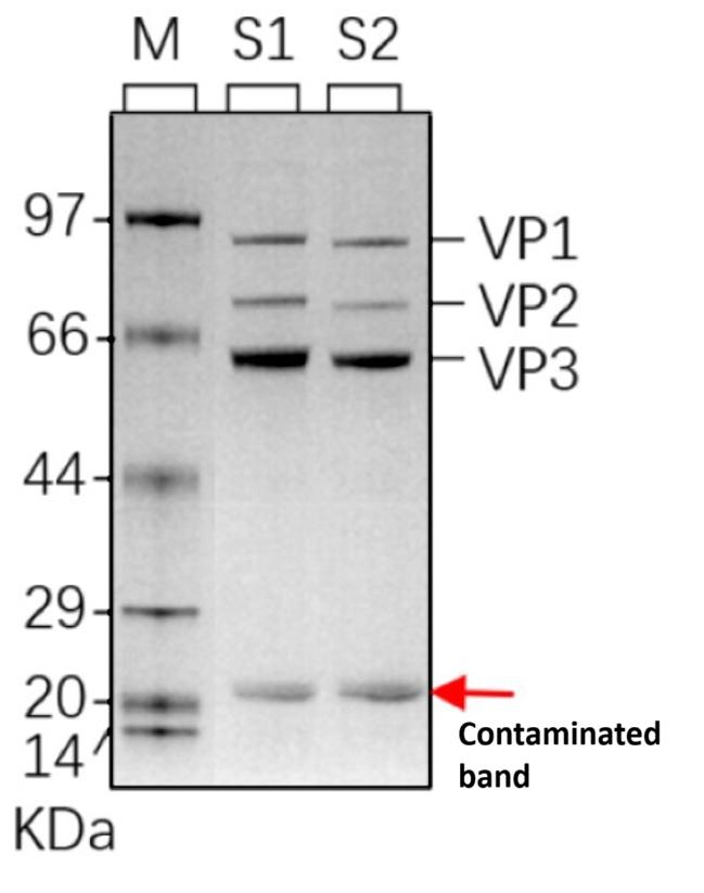 SDS-PAGE staining results of AAV samples