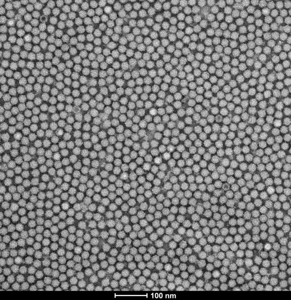 AAV negative staining TEM image after further purification