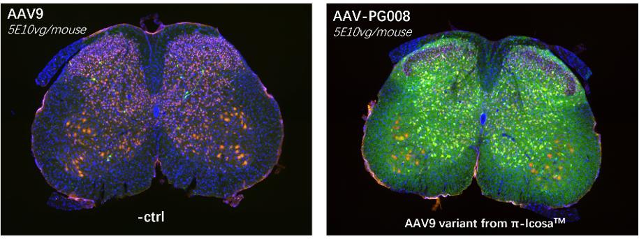 AAV-PG008-demonstrated-superior-GFP-expression-in-the-spinal-cord-and-cortex-compared-to-AAV9