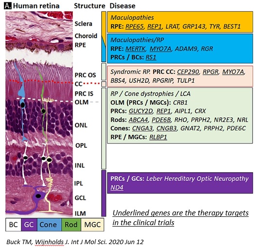 Retinal disease genes and therapy targets